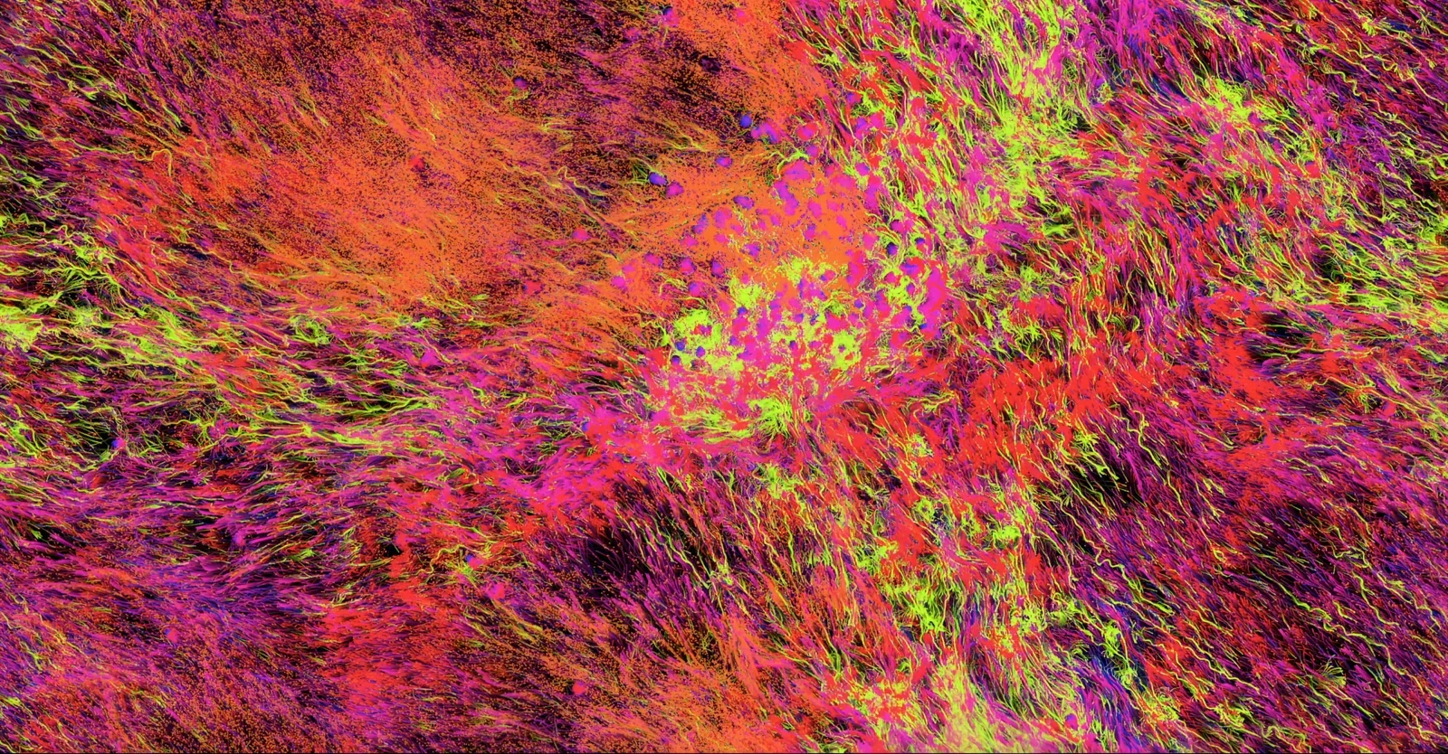 Hypercells — warm orange, red and magenta particle fibres with lime-green filaments crossing them, an orange bloom top left